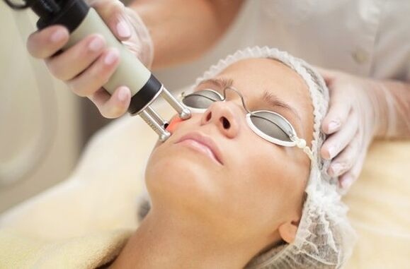 Thermal exposure to the epidermis